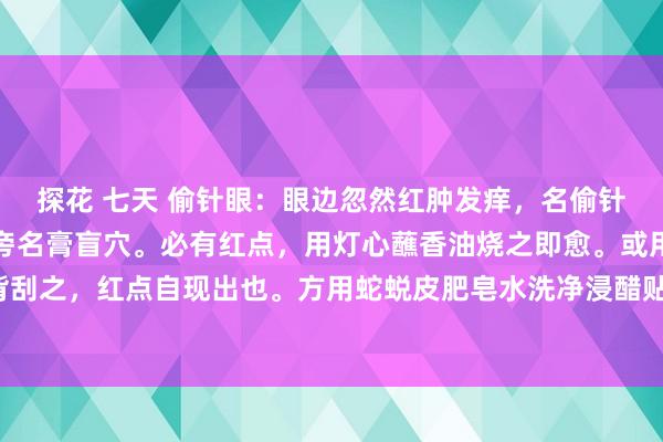 探花 七天 偷针眼：眼边忽然红肿发痒，名偷针眼。于背上第三节骨两旁名膏盲穴。必有红点，用灯心蘸香油烧之即愈。或用梳背刮之，红点自现出也。方用蛇蜕皮肥皂水洗净浸醋贴之立愈。或用臭虫血点搽甚效。